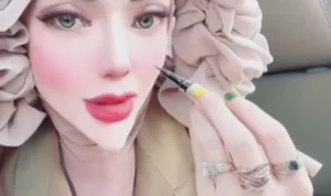 Viral di TikTok Wanita Punya Dagu yang Lancip, Kok Bisa? Ini Penjelasannya Viral di TikTok Wanita Punya Dagu yang Lancip, Kok Bisa? Ini Penjelasannya