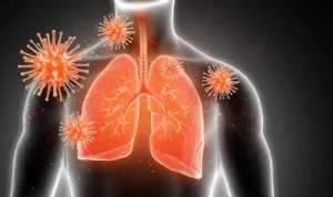 Vape Habit can Trigger Bronchitis!