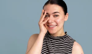 Cara Alami untuk Meredakan Flek Hitam di Wajah Viral di Medsos, Kilaukan Kulitmu Sekarang!