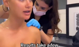 Memahami Fenomena Barbie Botox, Tren Kecantikan yang Sedang Viral di TikTok