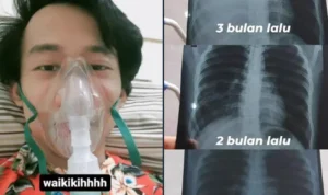 Viral di Twitter Kisah Pria Terkena Efusi Pleura, Apa Itu? Begini Penjelasannya Viral di Twitter Kisah Pria Terkena Efusi Pleura, Apa Itu? Begini Penjelasannya