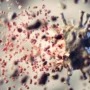 Ilustrasi virus Nipah yang kini tengah mewaba di India. (freepik)