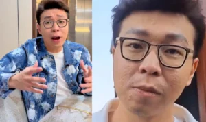 Klarifikasi dr Richard Lee Tentang Mukanya yang Bopeng