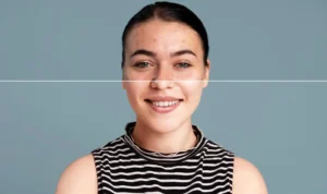 Tips dan Trik Cara Pulihkan Kulit Belang yang Efektif dan Aman