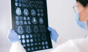 Hari Alzheimer Sedunia, Langkah Melawan Penyakit Menyakitkan