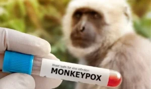 ILUSTRASI: Kasus cacar monyet atau Monkeypox (MPox) ang kini trus bertambah. (freepik)