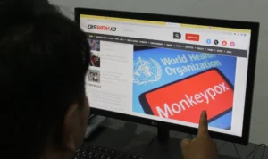 Waspada Penularan Cacar Monyet, Dinkes Cimahi: Belum Ada Laporan