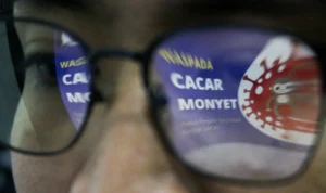 Dinkes Kabupaten Bandung Sebut Belum Ada Laporan Kasus Cacar Monyet Dinkes Kabupaten Bandung Sebut Belum Ada Laporan Kasus Cacar Monyet