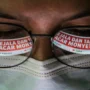 Waspada! Kasus Positif Cacar Monyet di Jawa Barat Naik