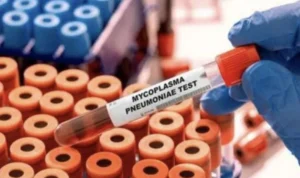 Pneumonia Mulai Masuk di Indonesia, Kemenkes Siapkan Jaringan Laboratorium