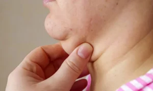 Tampil Percaya Diri Tanpa 'Double Chin'