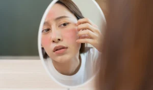 Mengatasi Wajah Kering dan Kusam: Penyebab dan Solusinya