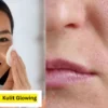Adakah Cara Mengecilkan Pori-pori Paling Ampuh? 5 Tips Perawatan Wajah untuk Kulit yang Lebih Sehat