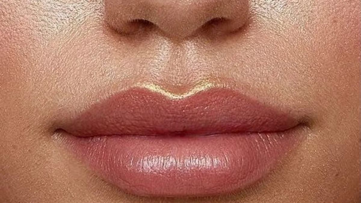 Intip Bahaya Filler Bibir Jika Sering Dilakukan, Bisa Infeksi Berlebih! Intip Bahaya Filler Bibir Jika Sering Dilakukan, Bisa Infeksi Berlebih!