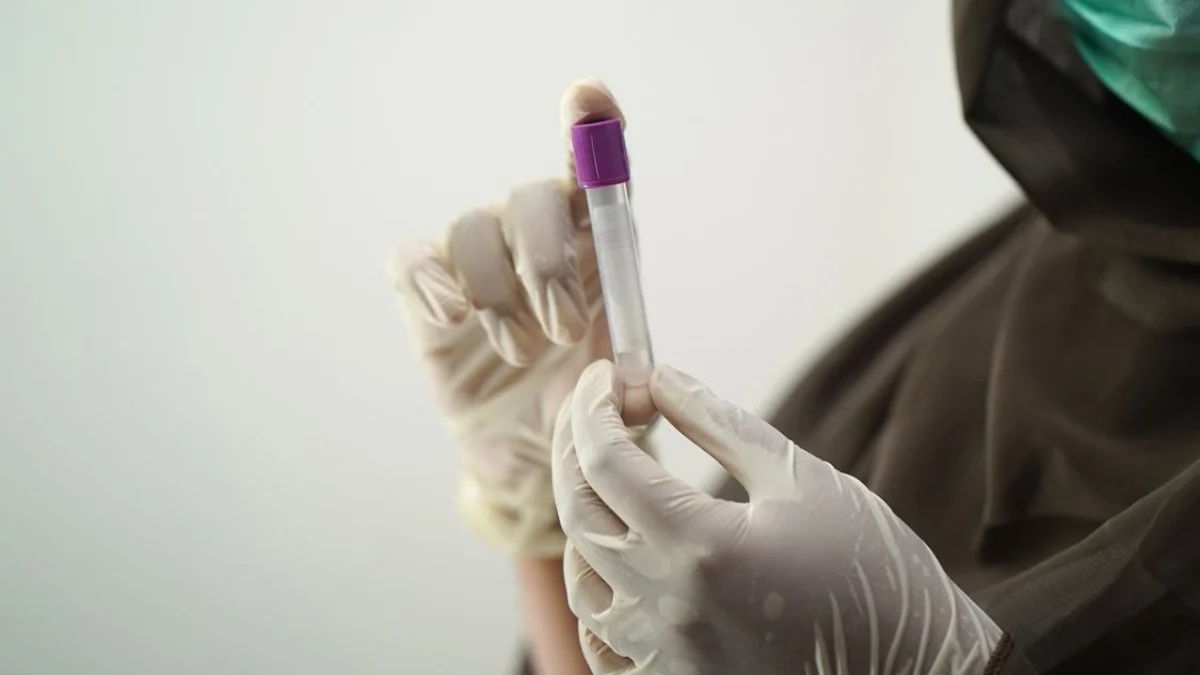 Ilustrasi sampel laboratorium. Foto dok (pixabay)