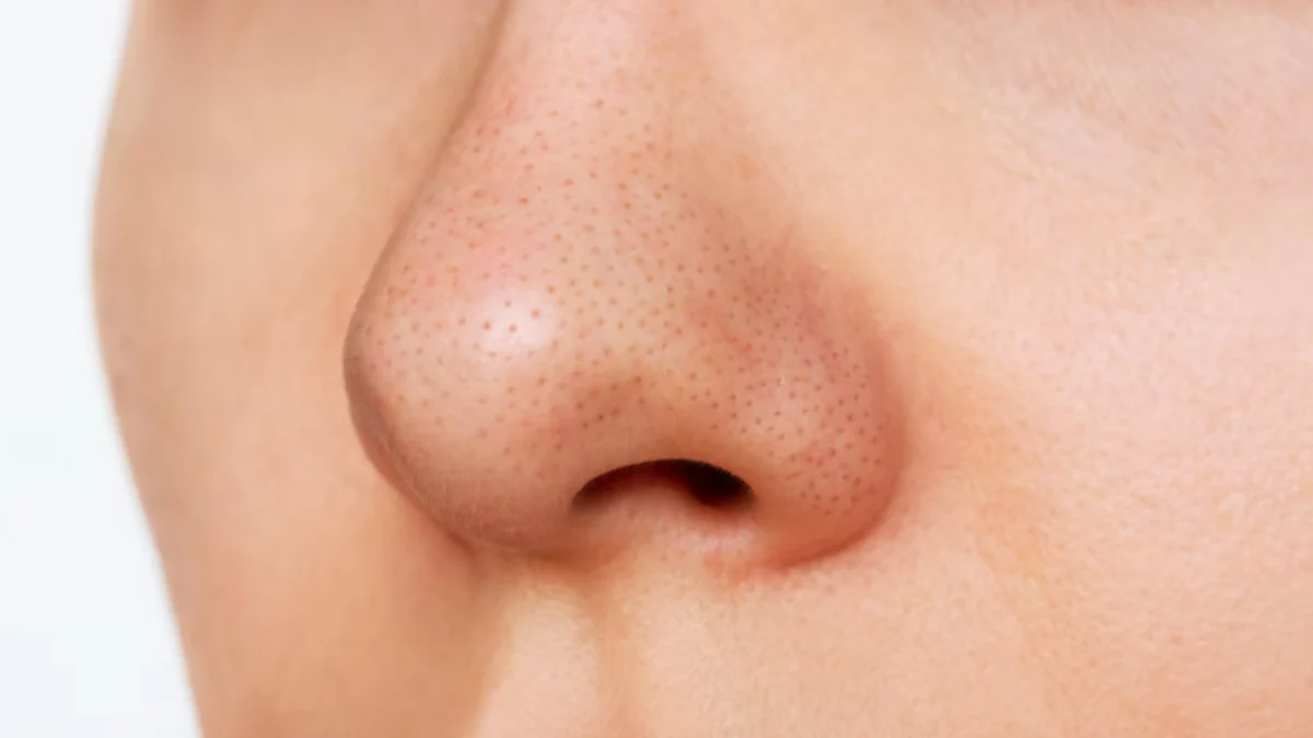 Cara Menghilangkan Komedo di Hidung, Sudah Coba? Cara Menghilangkan Komedo di Hidung, Sudah Coba?