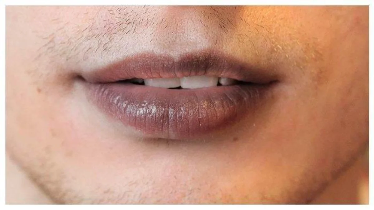 Bibir Hitam? Mungkin Kebiasaan Sehari-hari Ini Penyebabnya Bibir Hitam? Mungkin Kebiasaan Sehari-hari Ini Penyebabnya