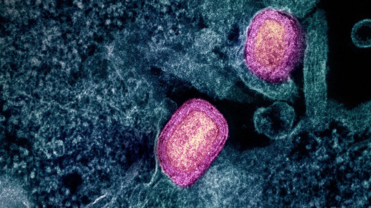 WHO Mengungkapkan Mpox Bukanlah Varian Baru Covid-19 WHO Mengungkapkan Mpox Bukanlah Varian Baru Covid-19