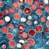 WHO Ungkap Virus Monkeypox Terdeteksi di Kongo jadi Darurat Kesehatan Global