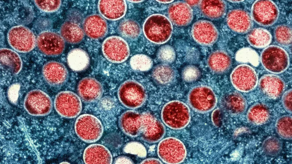 WHO Ungkap Virus Monkeypox Terdeteksi di Kongo jadi Darurat Kesehatan Global