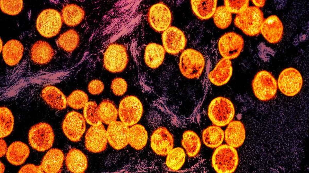 Seberapa Masif Penyebaran Wabah Mpox di Dunia? Kenali Gejalanya