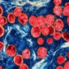 WHO Tetapkan Wabah Mpox sebagai Darurat Kesehatan Global