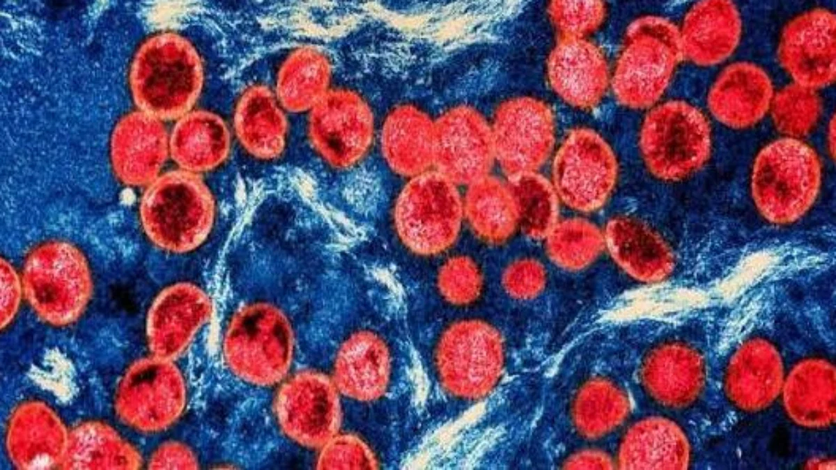 WHO Tetapkan Wabah Mpox sebagai Darurat Kesehatan Global WHO Tetapkan Wabah Mpox sebagai Darurat Kesehatan Global