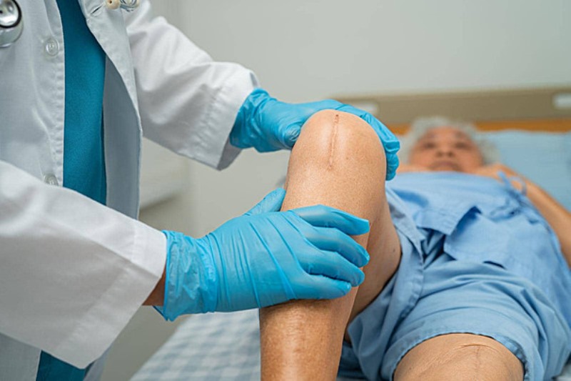 Tugas Dokter Orthopedi