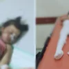 Noval Al-Qodri (10) dan Alina Faiza (6), warga Kecamatan Cipeundeuy, Bandung Barat dirawat di RSHS Bandung usai tersambar petir. Dok istimewa