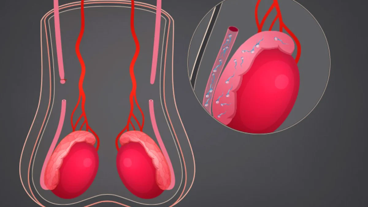 Pro Kontra Vasektomi