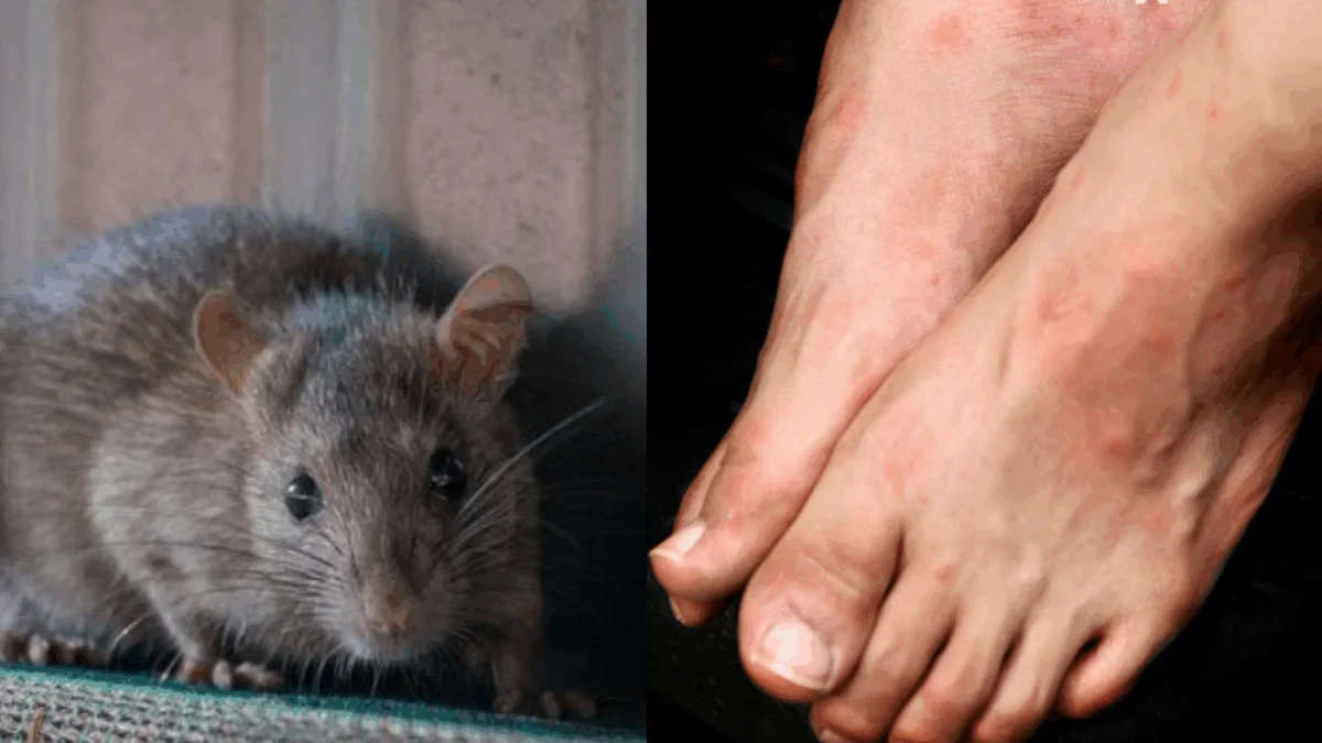 Warga Bandung Barat Kena Virus Mematikan Setelah Digigit Tikus, Ini Gejalanya