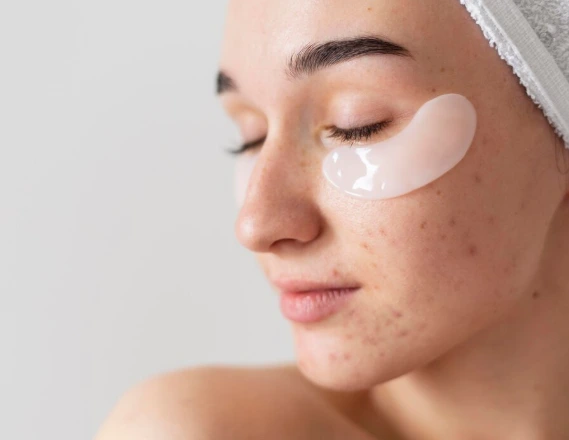 5 Serum untuk Jerawat yang Paling Direkomendasikan, No. 3 Wajib Dicoba! 5 Serum untuk Jerawat yang Paling Direkomendasikan, No. 3 Wajib Dicoba!