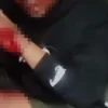 Korban mengaku dibegal ternyata murni kecelakaan/Istimewa