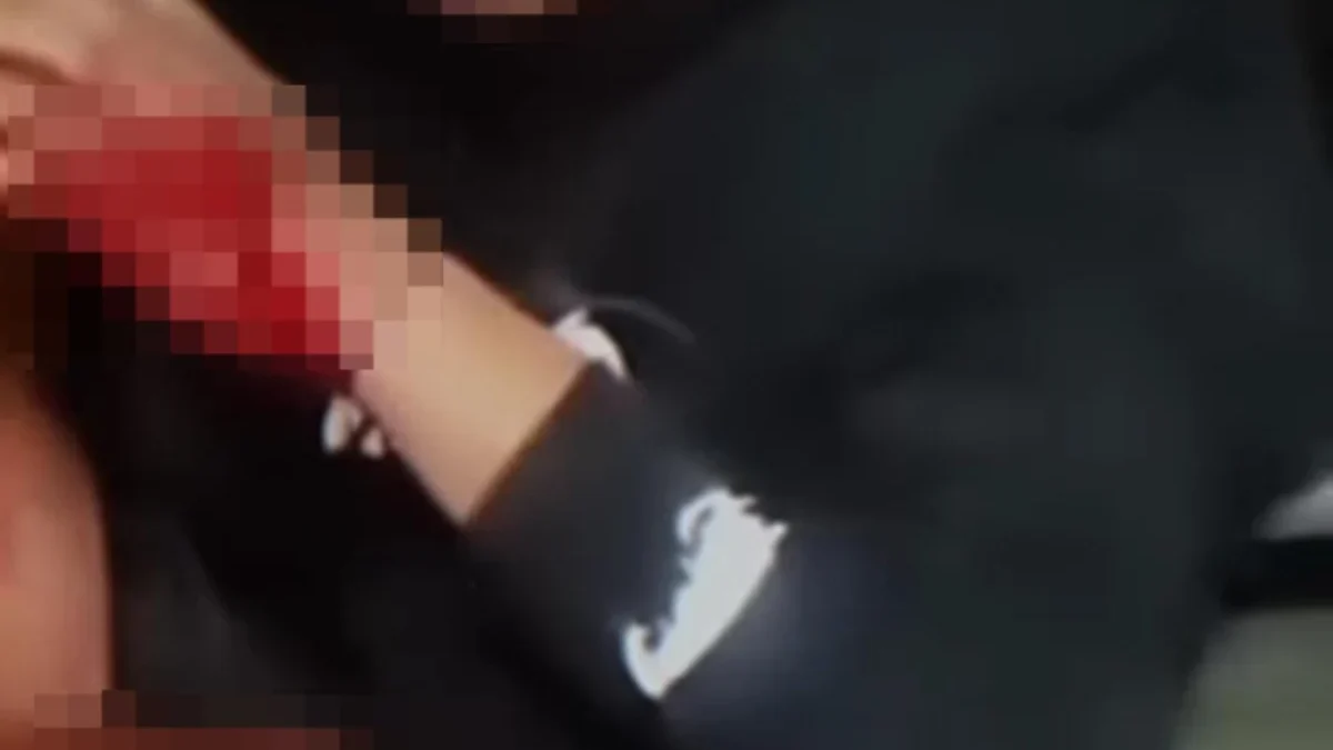 Beri Keterangan Palsu, Pria Ditemukan Penuh Luka di TPU Cikadut Ternyata Bukan Korban Begal! Korban mengaku dibegal ternyata murni kecelakaan/Istimewa