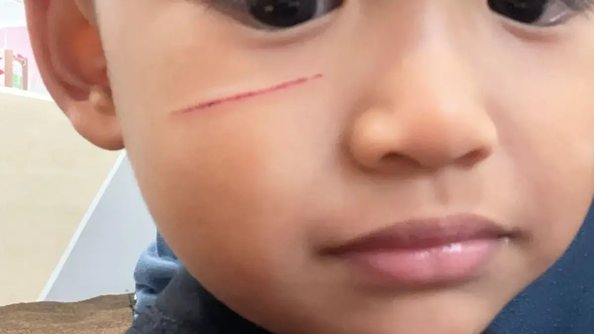 Balita Terluka Akibat Tiket Gelang di Arena Bermain Sumarecon Mall Bandung Sumarecon Mall Bandung