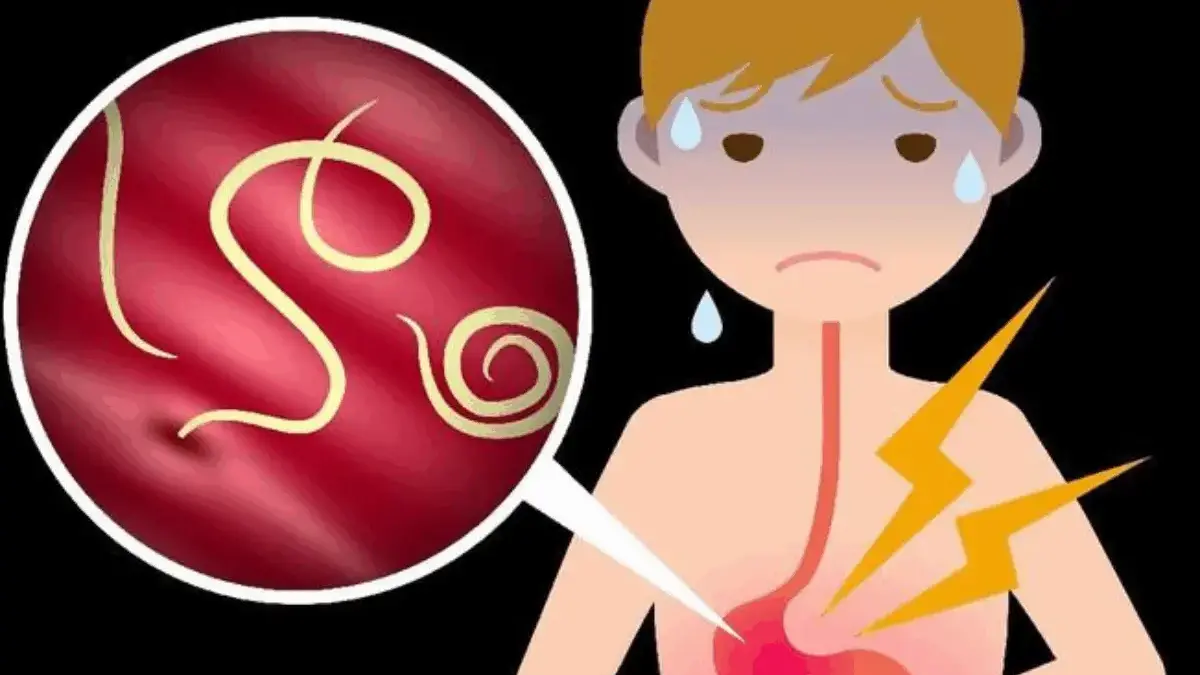 Belajar dari Balita di Sukabumi yang Meninggal Akibat Cacingan, Begini Cara Mencegah Penyakit Tersebut