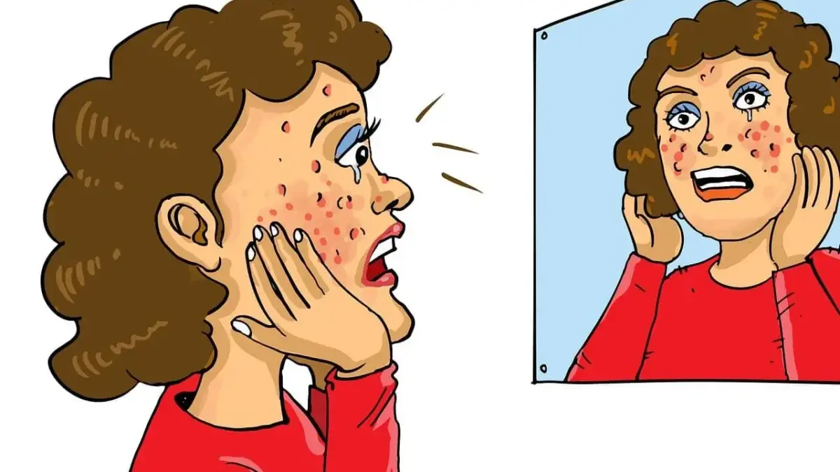 Ilustrasi 7 Tips Sederhana untuk Atasi Pori-Pori Bandel. Foto: Pixabay