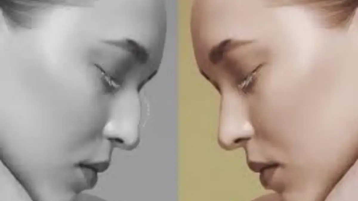 Hukum Tanam Benang di Hidung dalam Islam, Bolehkah Demi Kecantikan? Hukum Tanam Benang di Hidung dalam Islam