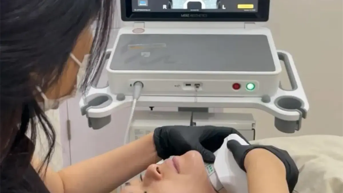 Ultherapy PRIME Pertama di Bandung Hadir di ADC Aesthetic Derma Centre: Lifting Tanpa Bedah Setara Face Lift