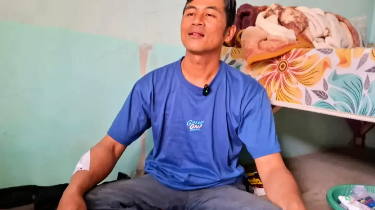 Detik-detik Ujang Anis Diserang Macan Tutul, Tangan Kanan Alami 9 Jahitan Usai Lindungi Anak-anak Ujang Anis (42), salah satu korban serangan macan tutul di kawasan permukiman di Desa Maruyung, Pacet