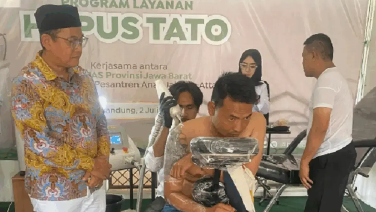 Baznas Jabar Gelar Program Hapus Tato Gratis, Bantu Pemuda Bandung Raya Kembali ke Dunia Kerja