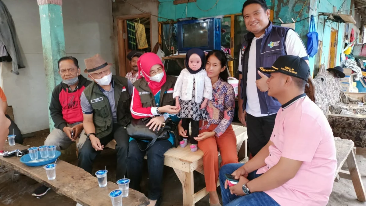 Menderita Penyakit Harlequin Ichthyosis, Elisa Segera Ditangani Medis