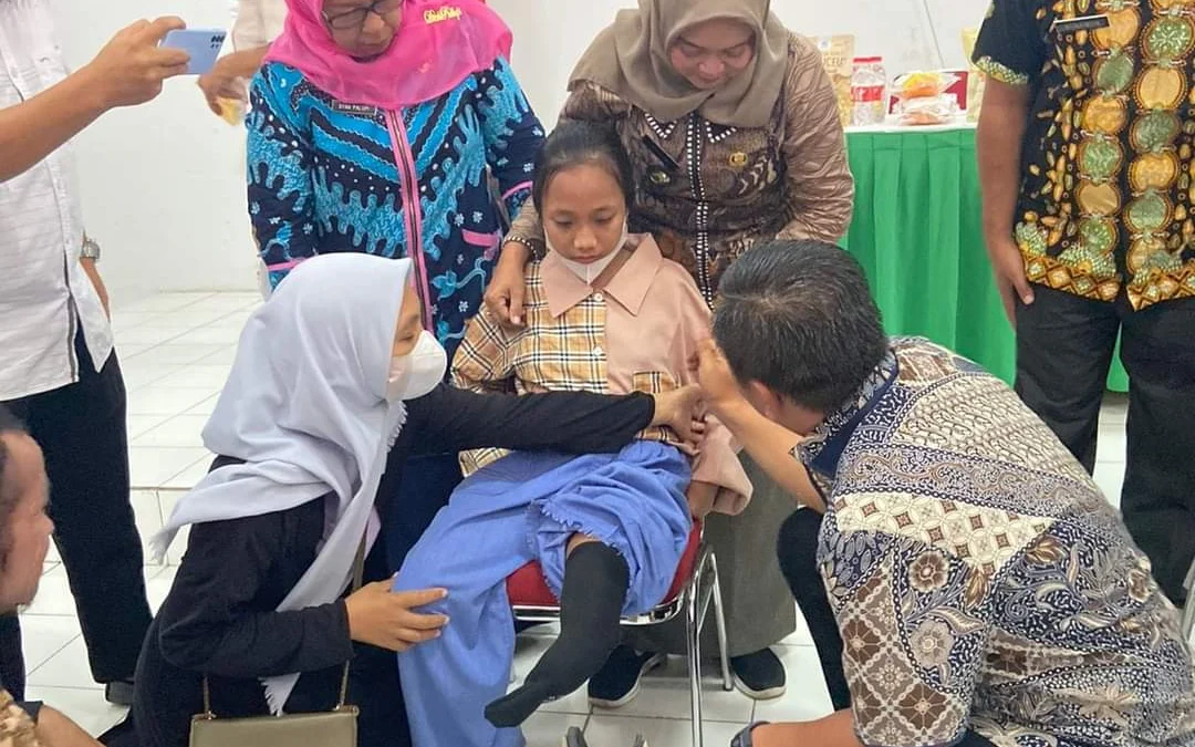 Buka Ruang Disabilitas di Tempat Kerja, Pemkab Karawang Bagikan Bantuan Kaki Palsu