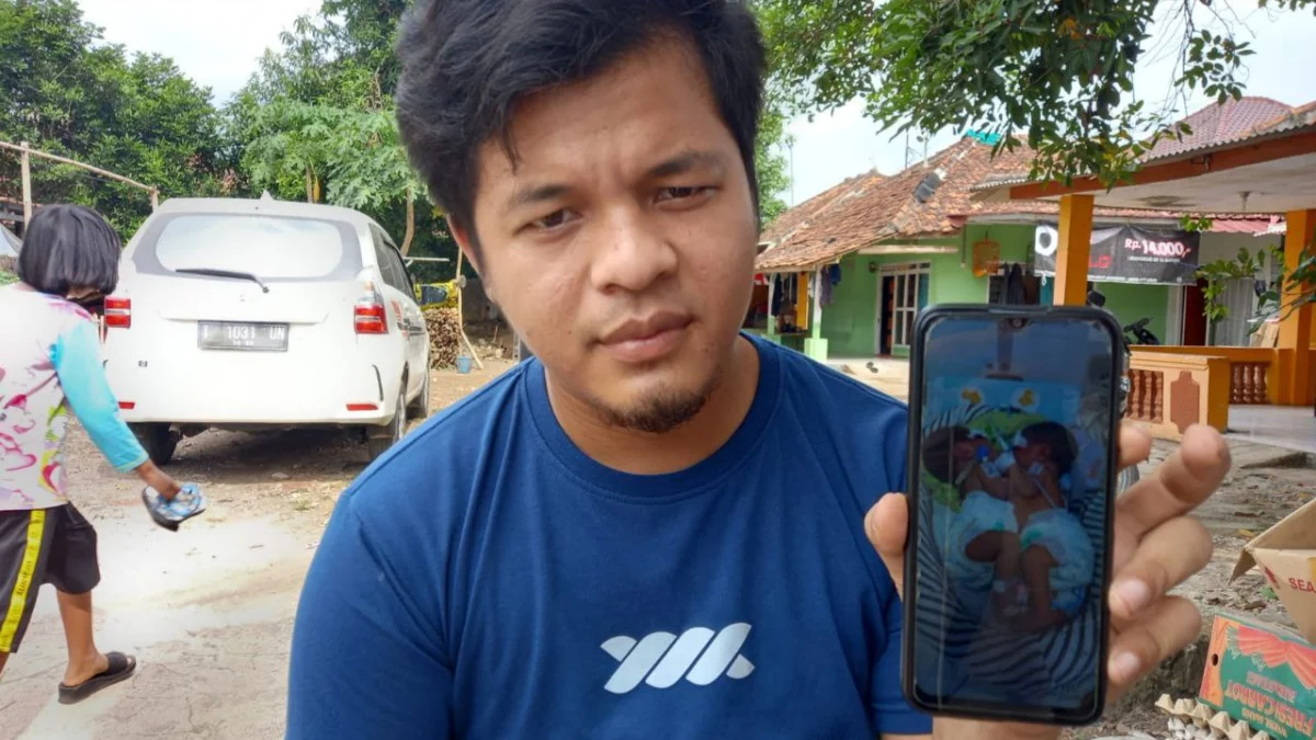 Pasutri Asal Subang Butuh Rp1,7 M untuk Operasi Bayi Kembar Siam