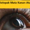 Akan Mendapatkan Banyak Rejeki, Ini Arti Kedutan Kelopak Mata Kanan Atas