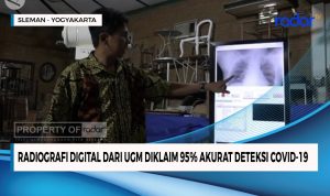 Radiografi Digital dari UGM Diklaim 95 Persen Akurat Deteksi Covid-19