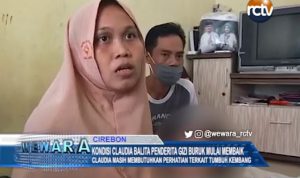 Balita Penderita Gizi Buruk di Kabupaten Cirebon Mulai Membaik