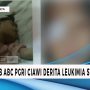 Siswi SLB ABC PGRI Ciawi Derita Leukimia Stadium 4