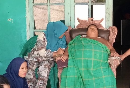 Kabar Duka, Bocah 11 Tahun Penderita Obesitas 126 Kilogram Meninggal Dunia