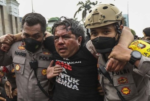 Polisi Tegaskan Akan Usut Pelaku Kasus Pemukulan Ade Armando